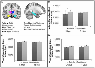 Differences in Brain Structure and Function Among Yoga Practitioners and Controls